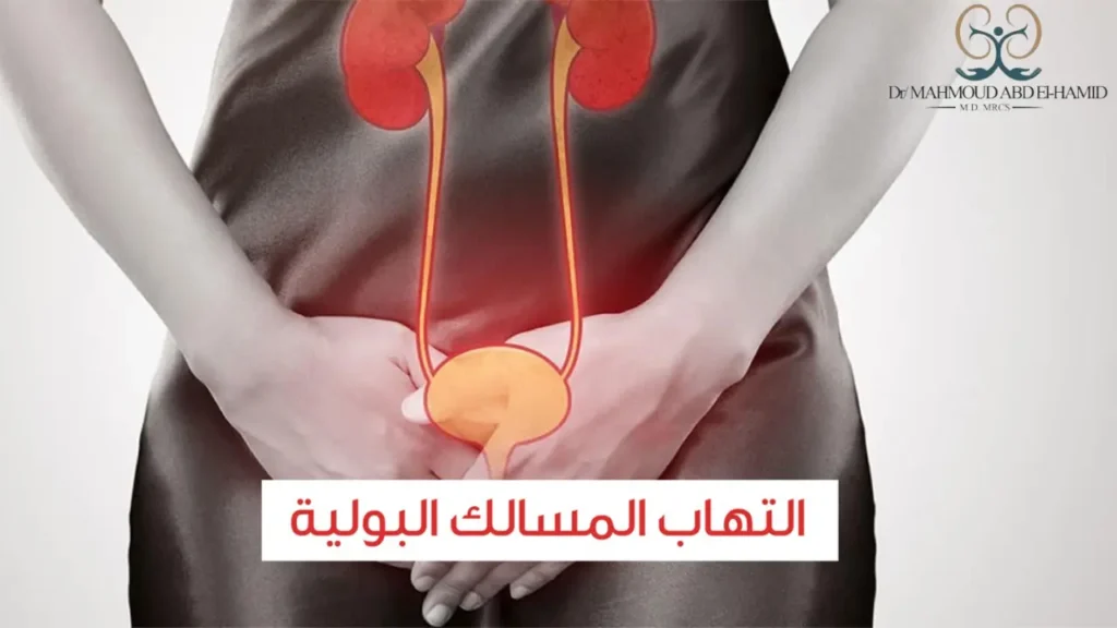 اسباب التهاب المسالك البولية - د.محمود عبد الحميد