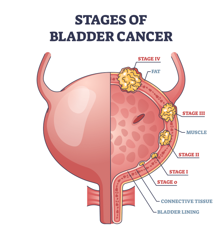 Cancer Treatment