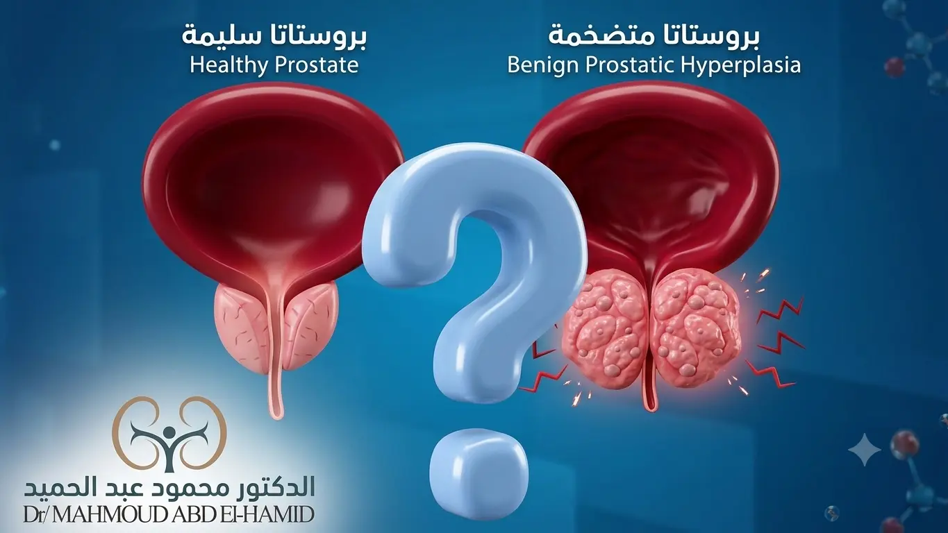 ما هى طرق علاج تضخم البروستاتا؟ الدليل الشامل لأحدث وسائل العلاج - د. محمود عبدالحميد